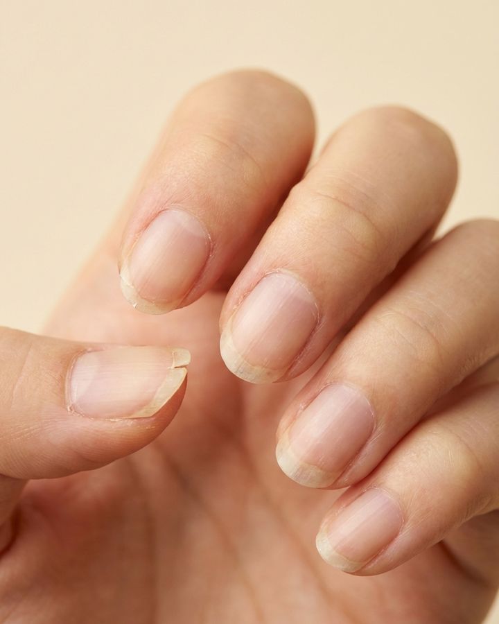 先端が薄く、二枚爪になりかけた自爪