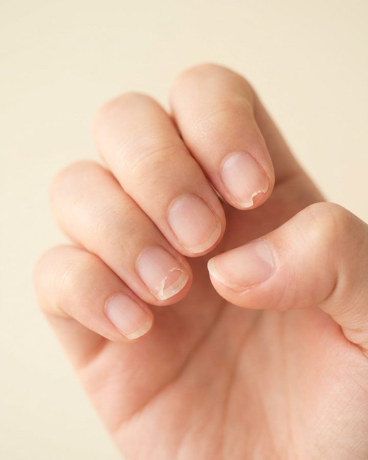 先端が薄く、二枚爪や小さな欠けがある自爪